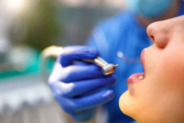 Dental Inlays and Onlays in West Haverstraw, NY